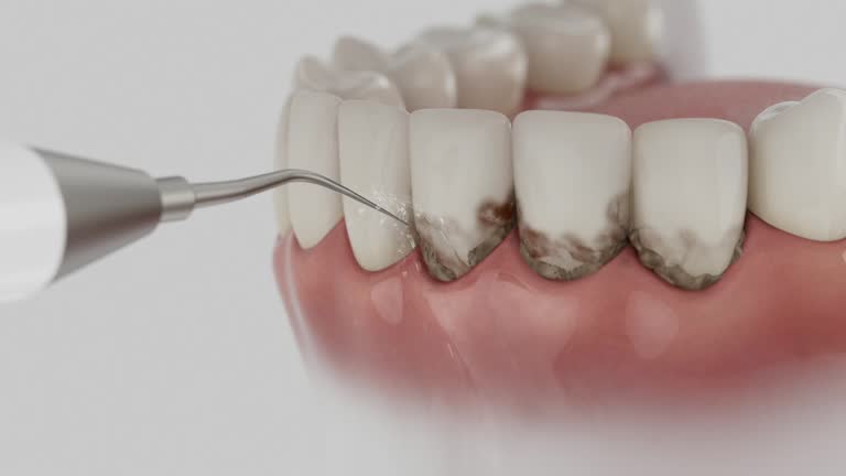 Reliable Tooth Extraction contractor in Seth Ward, TX by Smile Center Dentistry